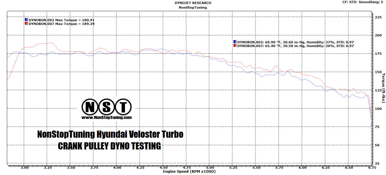 2011 - 2020 Hyundai Veloster Turbo Pulley Kit NST31600K